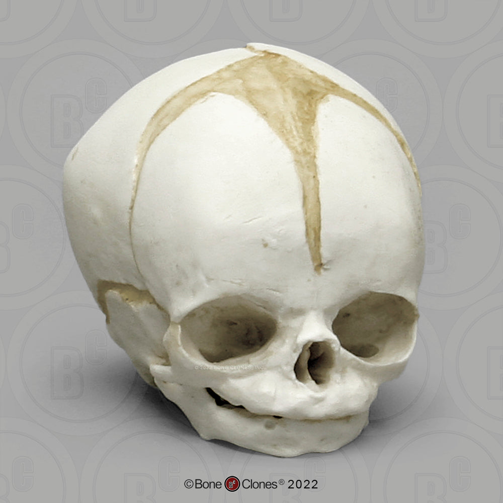Bone Clones Fetal Human Skulls Set Of 5 Homo sapiens 20 To 40 Weeks Medical replicas casts reproductions