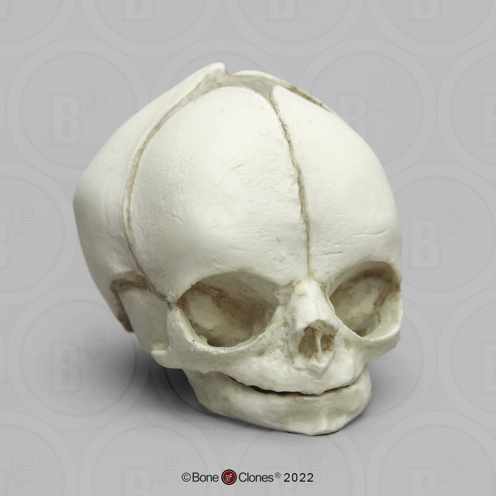 Bone Clones Fetal Human Skulls Set Of 5 Homo sapiens 20 To 40 Weeks Medical replicas casts reproductions
