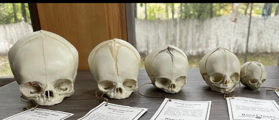 Bone Clones Fetal Human Skulls Set Of 5 Homo sapiens 20 To 40 Weeks Medical replicas casts reproductions