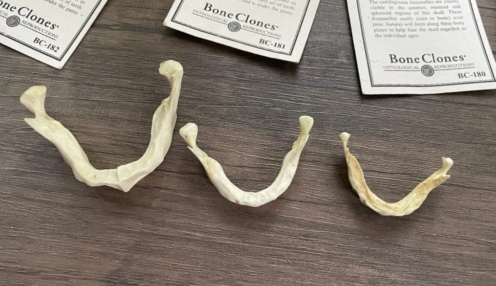 Bone Clones Fetal Human Skulls Set Of 5 Homo sapiens 20 To 40 Weeks Medical replicas casts reproductions