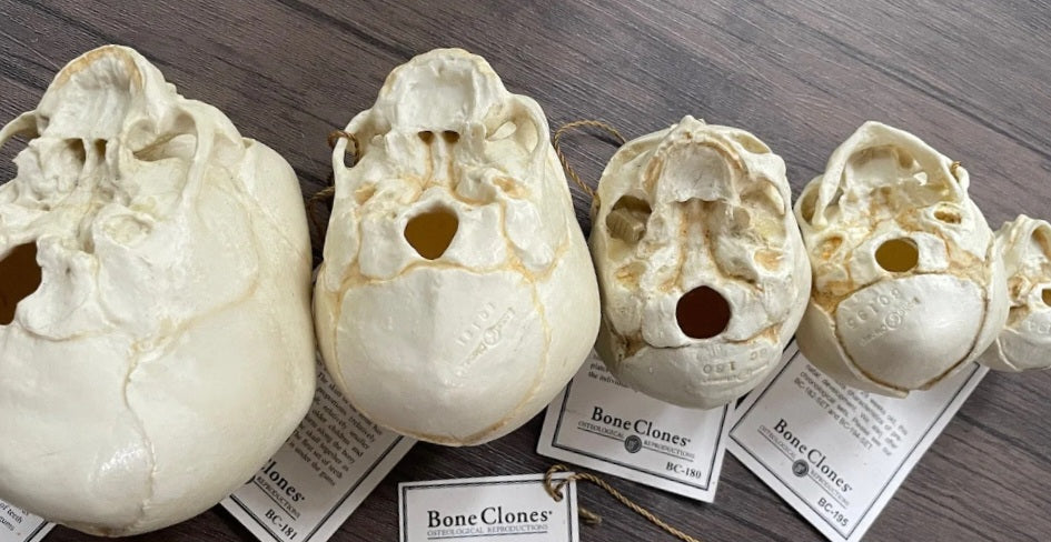 Bone Clones Fetal Human Skulls Set Of 5 Homo sapiens 20 To 40 Weeks Medical replicas casts reproductions