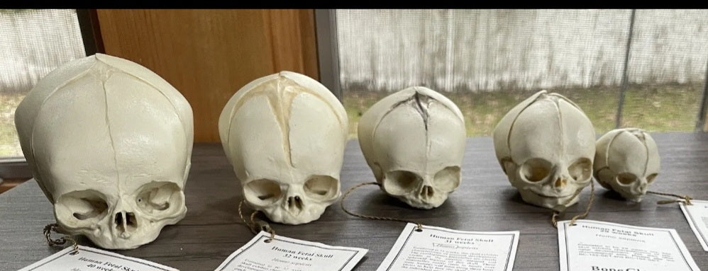 Bone Clones Fetal Human Skulls Set Of 5 Homo sapiens 20 To 40 Weeks Medical replicas casts reproductions