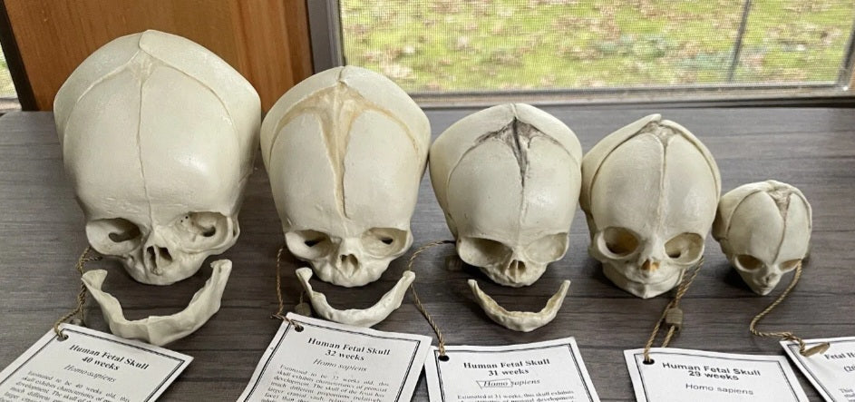 Bone Clones Fetal Human Skulls Set Of 5 Homo sapiens 20 To 40 Weeks Medical replicas casts reproductions