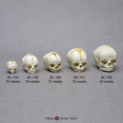 Bone Clones Fetal Human Skulls Set Of 5 Homo sapiens 20 To 40 Weeks Medical replicas casts reproductions