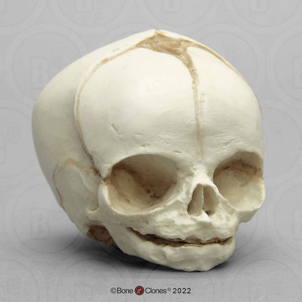 Bone Clones Fetal Human Skulls Set Of 5 Homo sapiens 20 To 40 Weeks Medical replicas casts reproductions