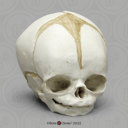 Bone Clones Fetal Human Skulls Set Of 5 Homo sapiens 20 To 40 Weeks Medical replicas casts reproductions