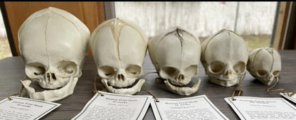 Bone Clones Fetal Human Skulls Set Of 5 Homo sapiens 20 To 40 Weeks Medical replicas casts reproductions
